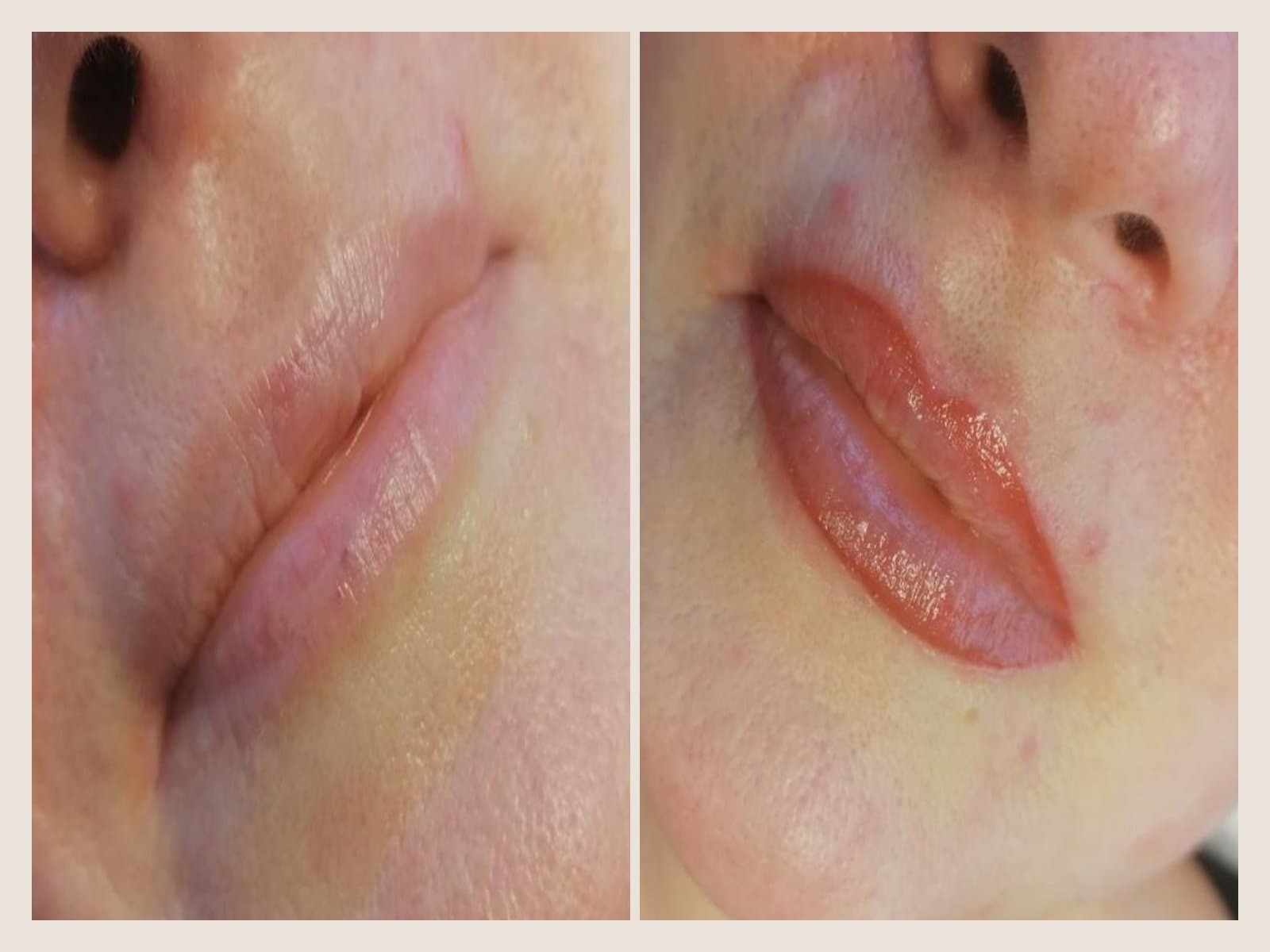 Lip blush before and after at LINÉA